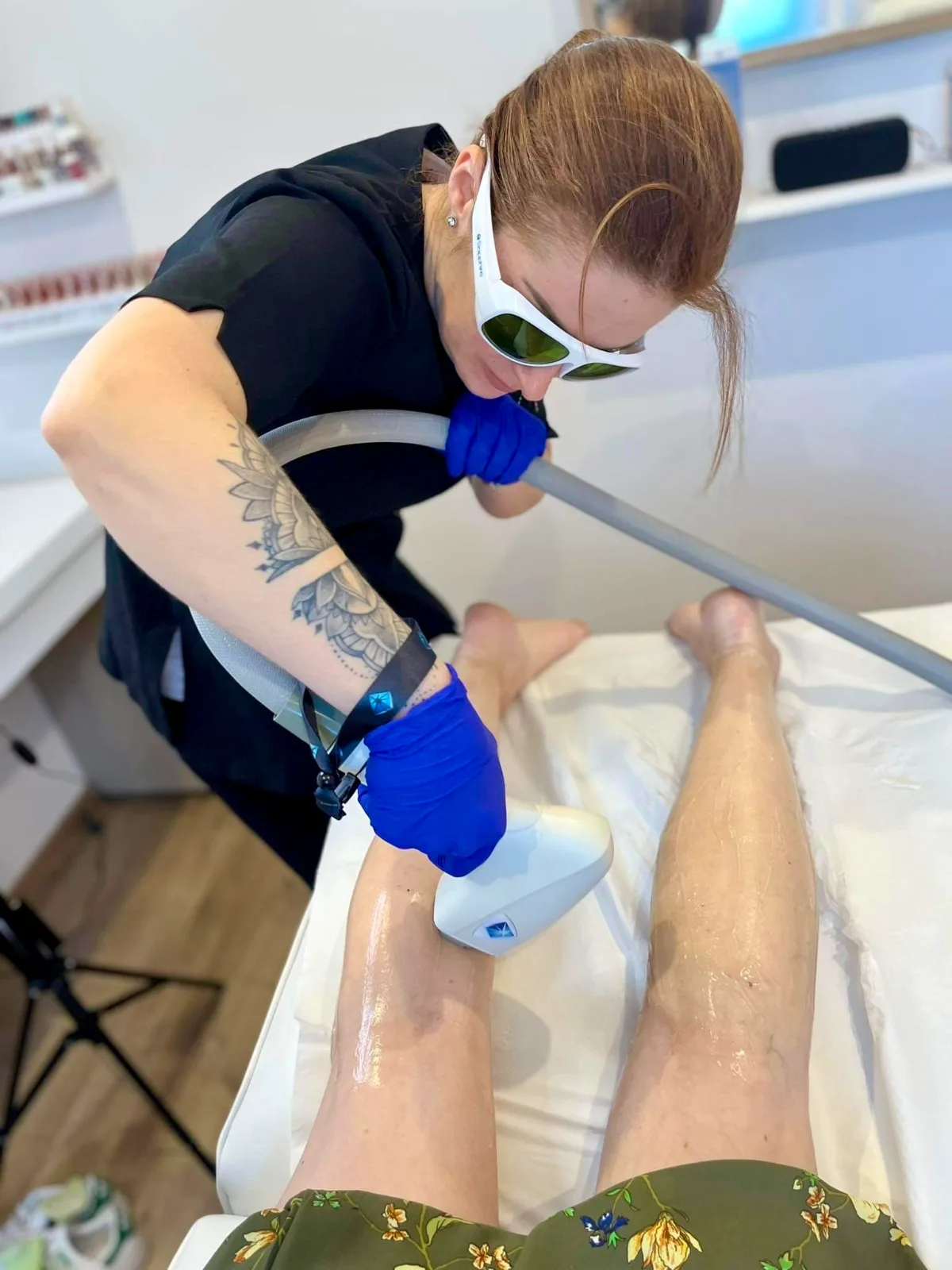 Dépilation laser